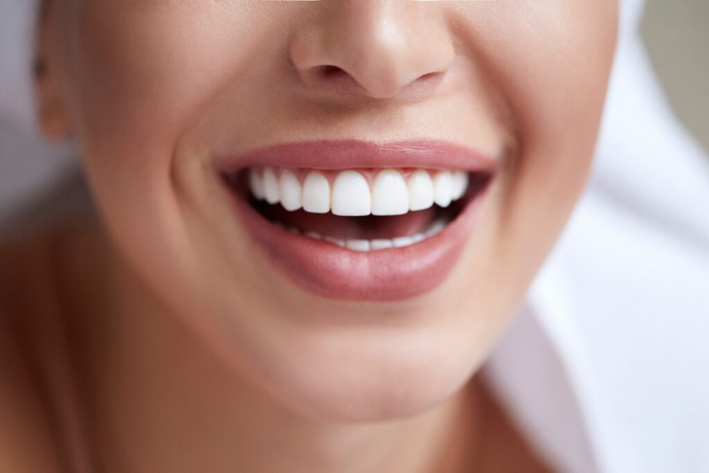 porcelian veneers